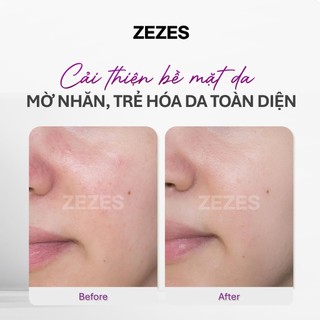 Tinh Chất Keo Ong  ZEZES A39 11 Peptide - Trẻ Hóa, Trắng Da Chống Lão Hóa Hàn Quốc 60ml MP1299
