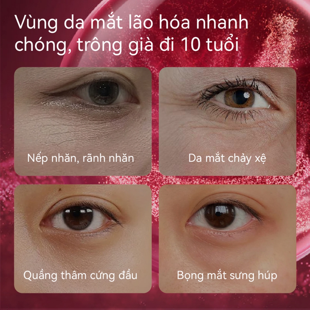 LANBENA MẶT NẠ MẮT ĐA PEPTIDE  & HOA HỒNG 7X (Hộp/60 miếng) - Giảm Nhăn, Làm Mờ Quầng Thâm, Trẻ Hóa Vùng Mắt Tự Nhiên