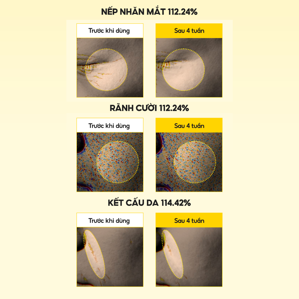 Kem Dưỡng Retinol Spicule 2000 shot Mary&May 15g | BigBuy360 - bigbuy360.vn