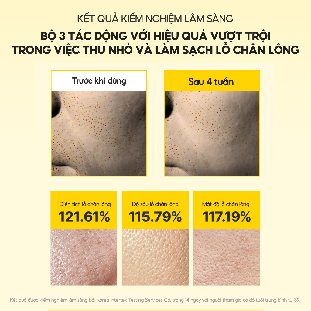 Kem Dưỡng Retinol Spicule 2000 shot Mary&May 15g | BigBuy360 - bigbuy360.vn