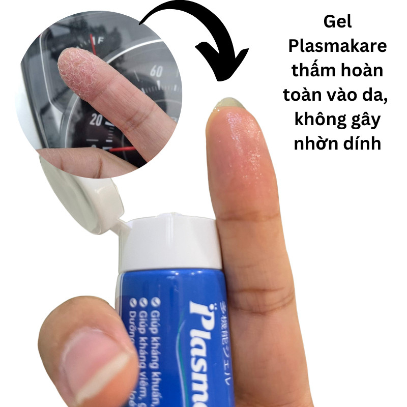Kem Bôi Da Á Sừng Plasmakare No5 Hỗ Trợ Phục Hồi Làn Da Nứt Nẻ Bong Tróc,Làm Da Mềm Mại No.5 No 5