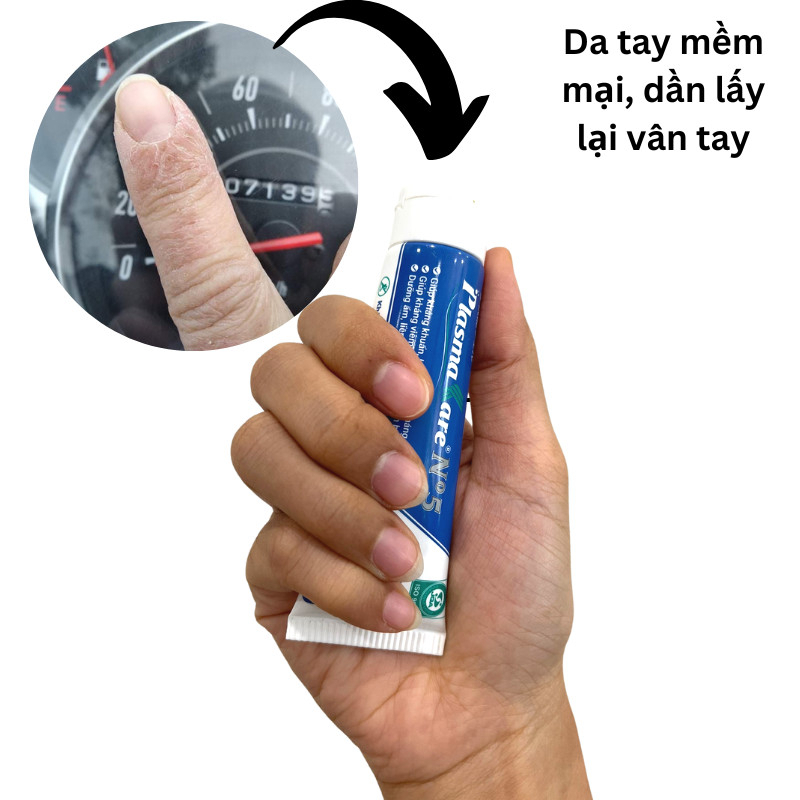 Kem Bôi Da Á Sừng Plasmakare No5 Hỗ Trợ Phục Hồi Làn Da Nứt Nẻ Bong Tróc,Làm Da Mềm Mại No.5 No 5