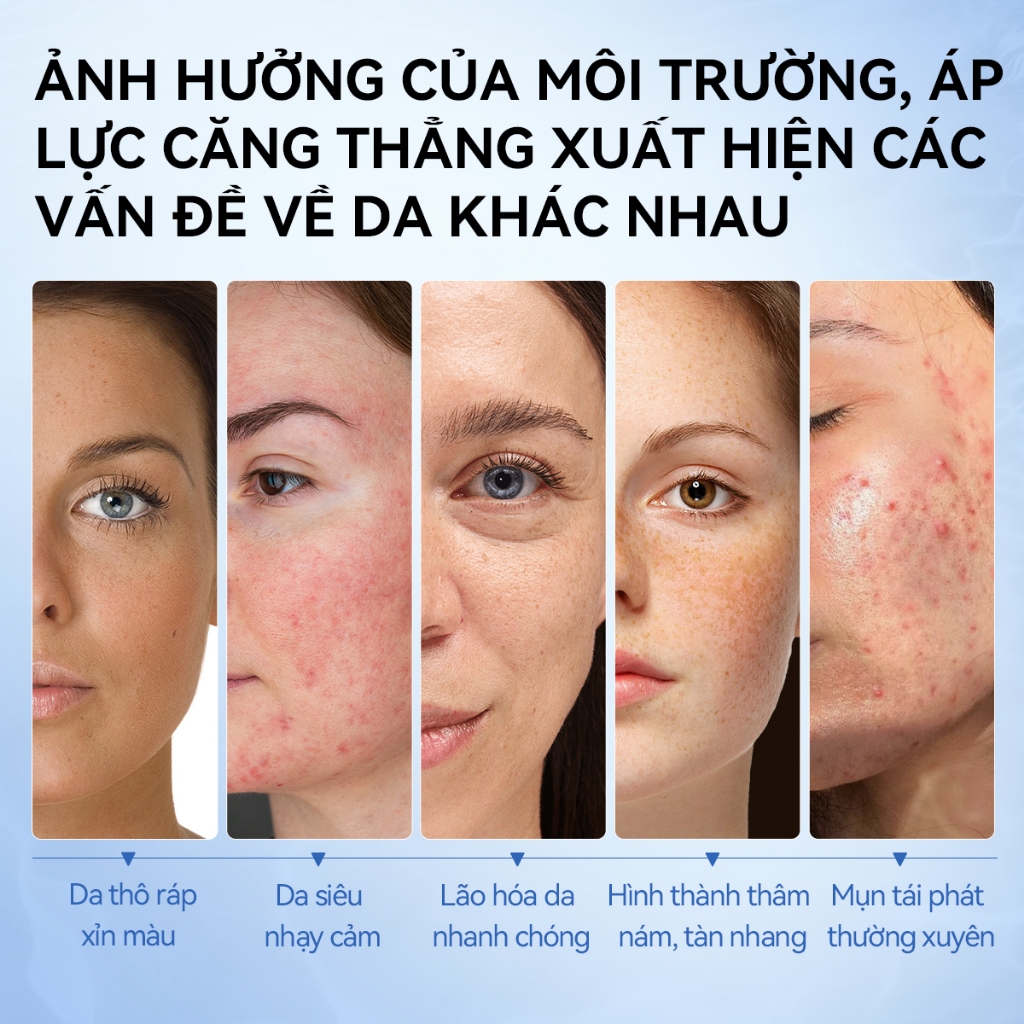 LANBENA5 PCS Mặt nạ  BHA,VC,VA,B5,B3 MULTI-VITAMINS (25ml) - PHỤC HỒI, DƯỠNG ẨM, TRẮNG DA, GIẢM NHĂN, LÀM DỊU DA Skincar