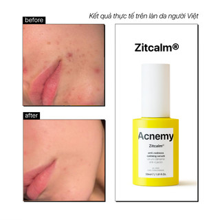 Serum Làm Dịu Và Cân Bằng Hệ Vi Sinh, Giảm Đỏ Và Kháng Khuẩn Acnemy Zitcalm Serum