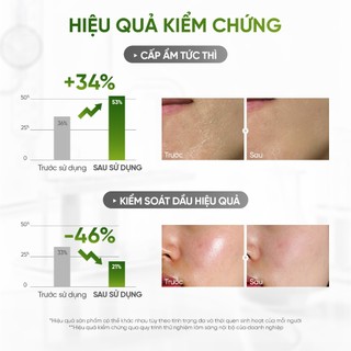 [Combo Sữa Rửa Mặt + Serum Giảm Mụn Kiềm Dầu] DAILY EFFECT Daily Cleansing Gel + Phytosome Pore - Refining Serum (120g )