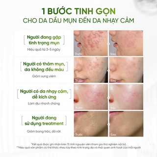 [Combo Sữa Rửa Mặt + Serum Giảm Mụn Kiềm Dầu] DAILY EFFECT Daily Cleansing Gel + Phytosome Pore - Refining Serum (120g )