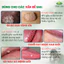 Tinh Chất Hỗ Trợ Xử Lý Sùi Mào Gà, Hạt Ngọc, Mụn Li Ti 10ml (Che Tên) AMN 10ML [S]