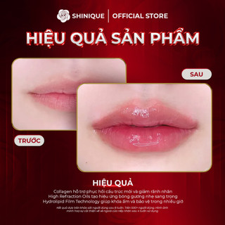 SHINIQUE Collagen Protect Lip Balm 9g - Son Dưỡng Môi Collagen Kết Hợp Siêu Vitamin Giúp Bảo Vệ & Chăm Sóc Môi Hằng Ngày