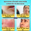 BETA BÉXIKOR - Toner cấp ẩm phù hợp mọi loại da, chống oxy hóa, tái tạo da