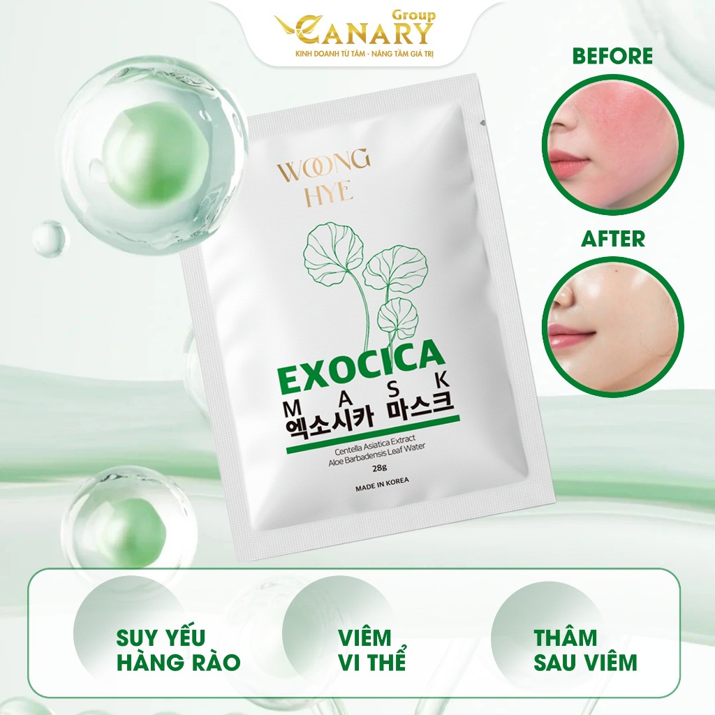 Mặt nạ rau má Exocica Woong Hye, cấp ẩm, làm dịu da, phù hợp da yếu da nhạy cảm 28g - EXOCICA MASK