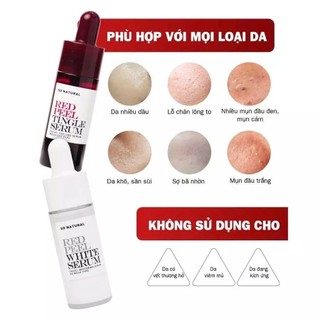 Tinh Chất Peel Da Red Peel Tingle Tẩy Da Chết Serum Tái Tạo Da Red Peel Làm Sáng Da Thu Nhỏ Chân Lông - Skinora Beauty