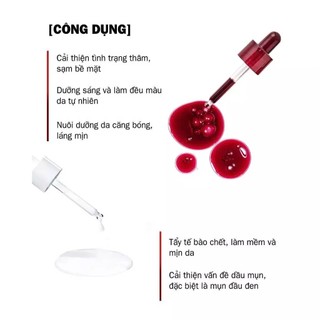 Tinh Chất Peel Da Red Peel Tingle Tẩy Da Chết Serum Tái Tạo Da Red Peel Làm Sáng Da Thu Nhỏ Chân Lông - Skinora Beauty