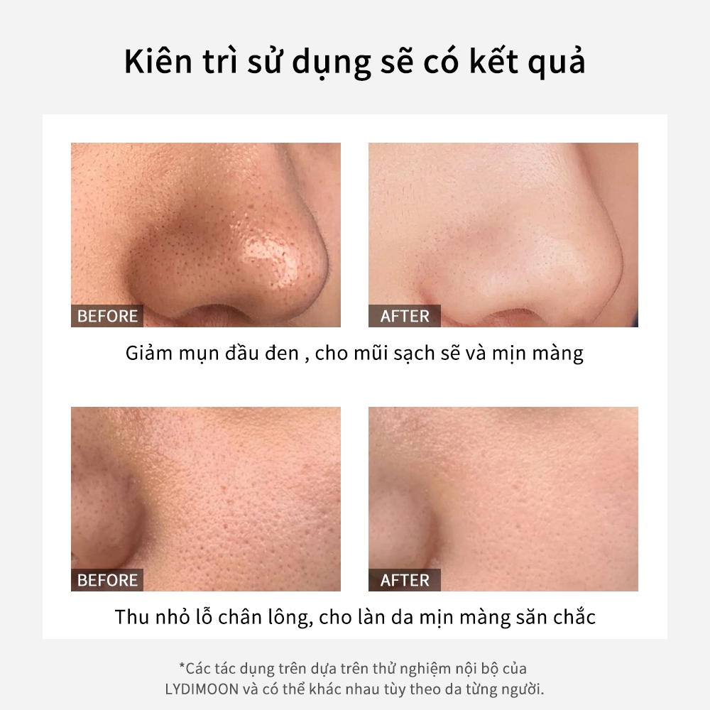 Mặt nạ lột than tre đen LYDIMOON 60g loại bỏ mụn đầu đen se khít lỗ chân lông Mặt nạ dịu nhẹ thanh lọc