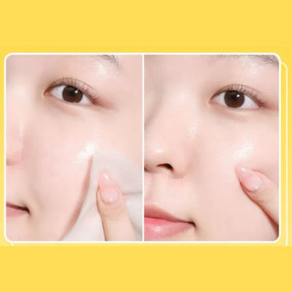 [MediAnswer] Toner Pad Dưỡng Sáng Căng Bóng Da MediAnswer Vita Collagen Glow Pad | Hộp 80 Miếng/140ml
