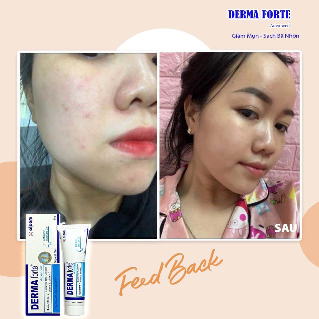 Derma Forte 15g - Gamma, Bản Advanced, Gel Giúp Giảm Mụn Trứng Cá, Ngừa Thâm, Mờ Sẹo, Da Dầu Mụn