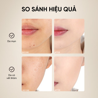 [Y379] Bộ Cọ Mút Che Khuyết Điểm AMORTALS - Nhiều Đầu Chuyên Dụng, Che Phủ Tố, Không Bám Kem, Dễ Dùng Cho Người Mới