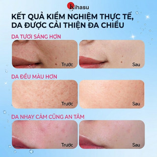 Kem dưỡng Collagen Kihasu cấp ẩm sáng da mờ thâm phục hồi da khô da nhạy cảm căng bóng