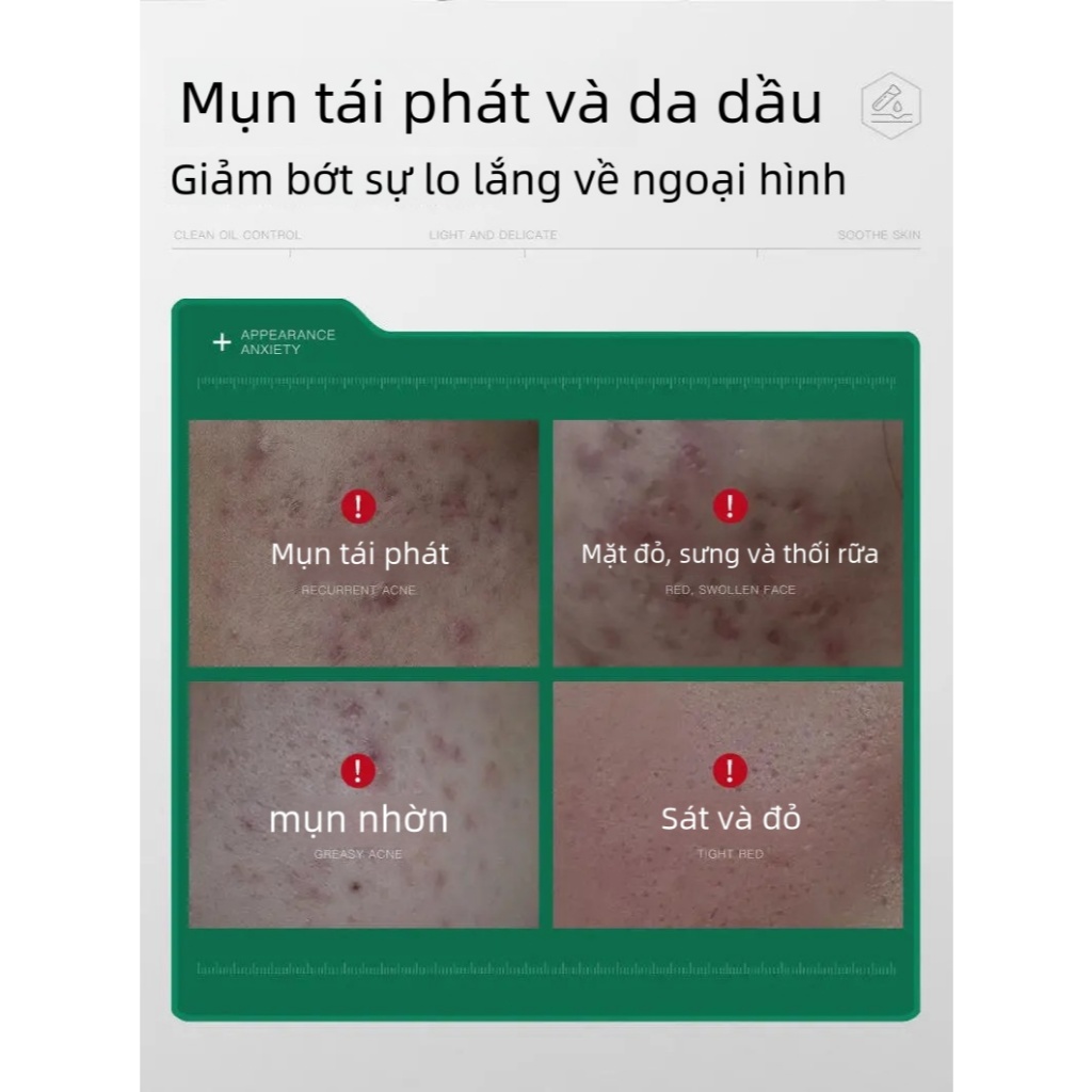 [MUA 2 GIẢM 50%] Kem Chấm Giảm Mụn Azelaic Acid 20g Hỗ Trợ Làm Dịu Mụn Kiểm Soát Dầu Thừa Cho Da Mụn