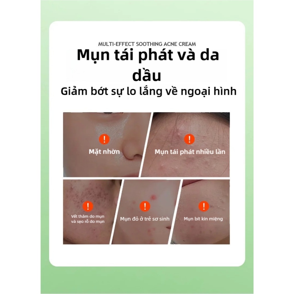 [MUA 2 GIẢM 50%] Kem Chấm Giảm Mụn Azelaic Acid 20g Hỗ Trợ Làm Dịu Mụn Kiểm Soát Dầu Thừa Cho Da Mụn