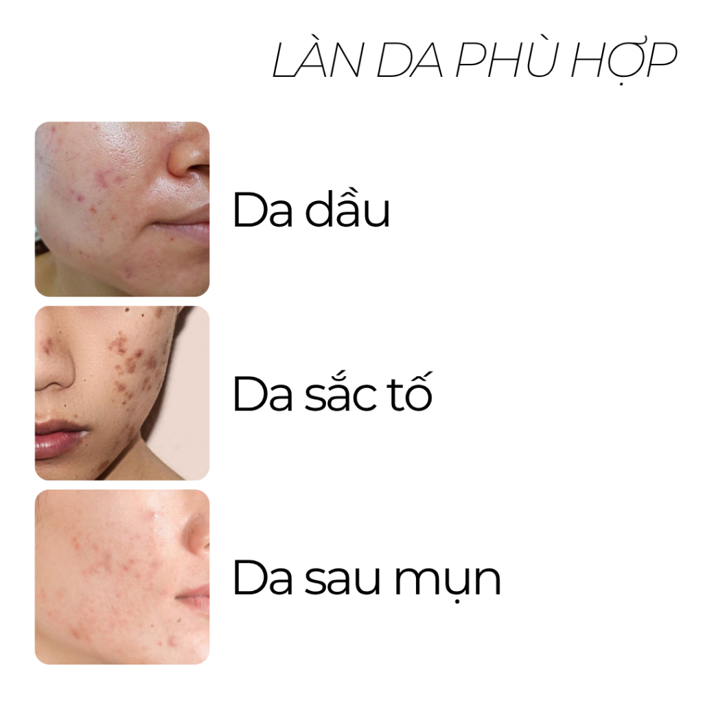 Combo Chăm Sóc Da 3 Bước, Sữa rửa mặt 100ml + Serum B3 30ml + Gel dưỡng 50ml - CB4