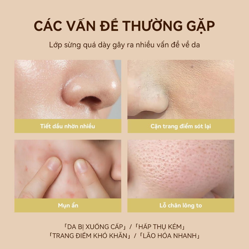LANBENA Xịt Tẩy Tế Bào Chết Mặt  (30ml) - Làm Sạch Sâu,Cải Thiện Làn Da Thô Ráp,Tiết Dầu,Giảm Mụn tẩy da chết Skincare