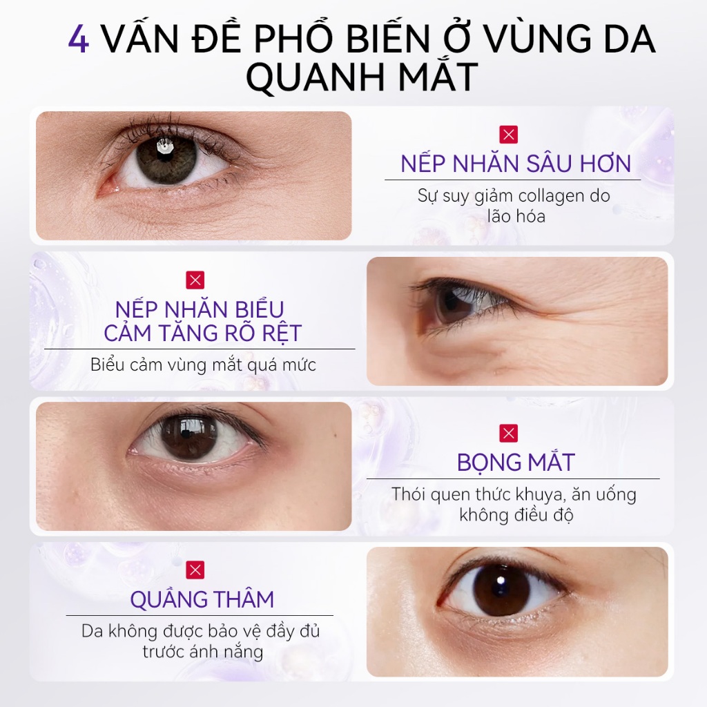 LANBENA Kem Mắt Retinol  (15ml)-  Đầu Massage Lạnh Giúp Giảm Nếp Nhăn, Mờ Quầng Thâm Mắt,Dưỡng ẩm Trắng Da, Hạn Chế Lão