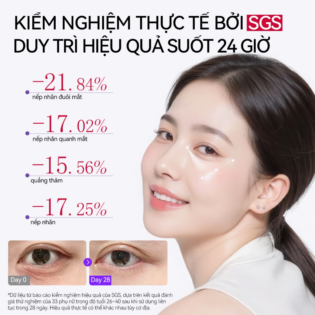 LANBENA Kem Mắt Retinol  (15ml)-  Đầu Massage Lạnh Giúp Giảm Nếp Nhăn, Mờ Quầng Thâm Mắt,Dưỡng ẩm Trắng Da, Hạn Chế Lão