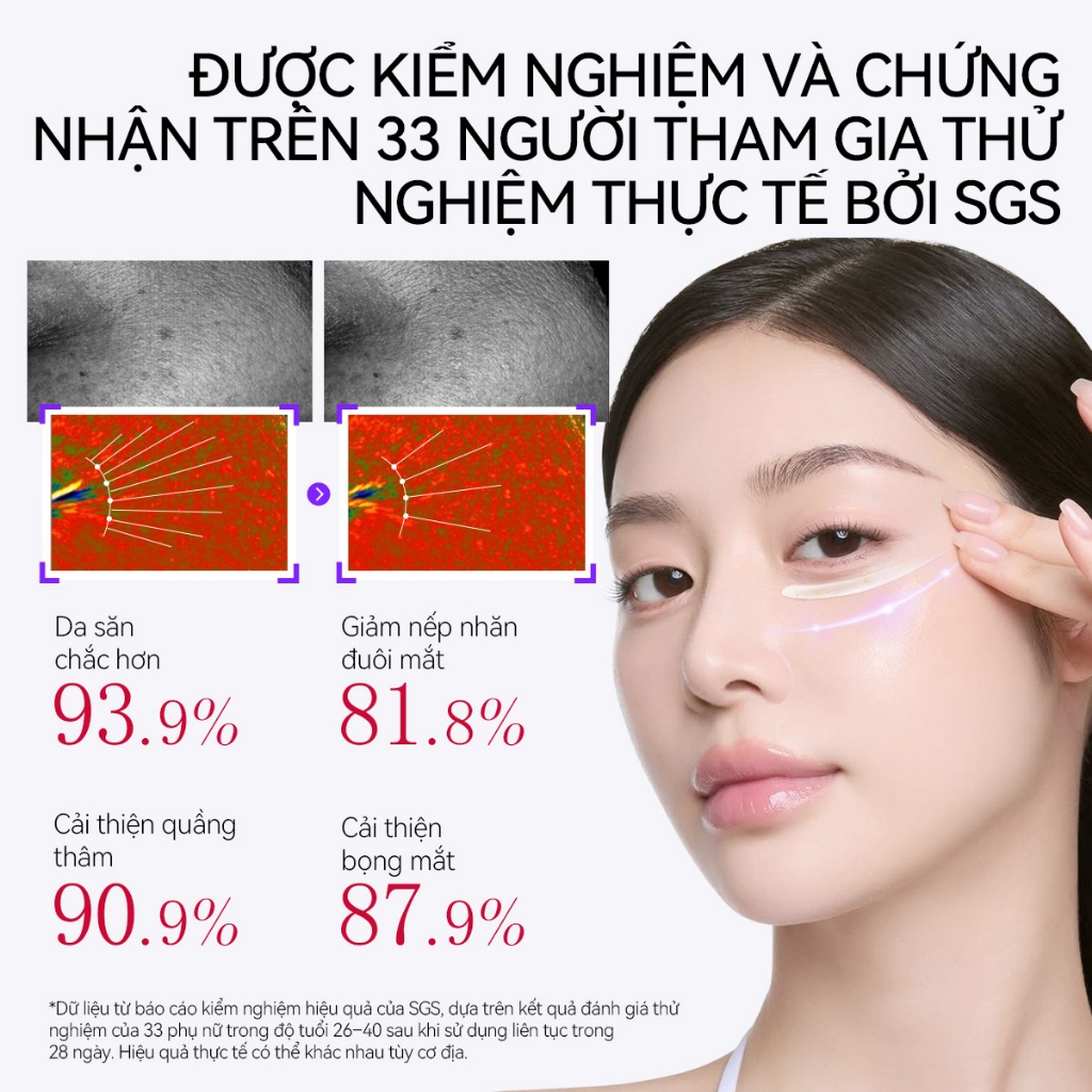 LANBENA Kem Mắt Retinol  (15ml)-  Đầu Massage Lạnh Giúp Giảm Nếp Nhăn, Mờ Quầng Thâm Mắt,Dưỡng ẩm Trắng Da, Hạn Chế Lão