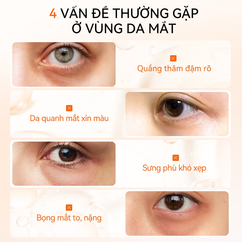 LANBENA Kem Mắt  Vitamin C Đầu Massage Lạnh (15ml) - Giúp Giảm Thâm Quầng Mắt, Giảm Bọng, Giảm Nếp Nhăn,Làm Sáng Da Mắt