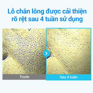 Tinh chất chống lão hoá NUMBUZIN No.3 Blue Bio-Retinol Pore Refining Serum, giảm kích ứng, se khít lỗ chân lông 30ml