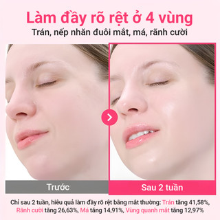 Tinh chất căng bóng NUMBUZIN No.2 Rose PDRN Collagen Plumping Serum, tăng độ đàn hồi, phục hồi da 30ml