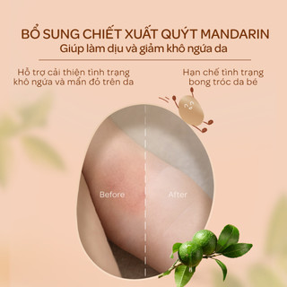 Kem dưỡng ẩm cho bé Huggies Power of Seed 150g MỚI với tinh chất Moroccan Seed oil quý hiếm