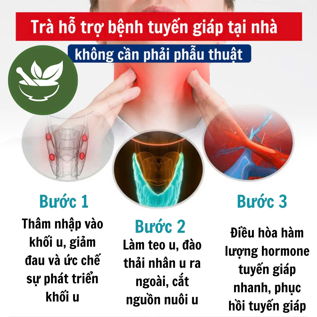 Trà Tiêu U Giáp Thảo Mộc - Giúp Vùng Cổ Dễ Chịu, Cân Bằng Cơ Thể, Duy Trì Trạng Thái Khỏe Khoắn Tự Nhiên