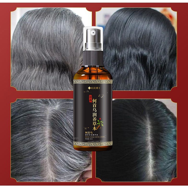 [MUA 2 GIẢM 50%] Tinh Chất Mọc Tóc Nhân Sâm 100ml Dưỡng Tóc Chắc Khỏe Hỗ Trợ Giảm Gãy Rụng Và Nuôi Dưỡng Da Đầu