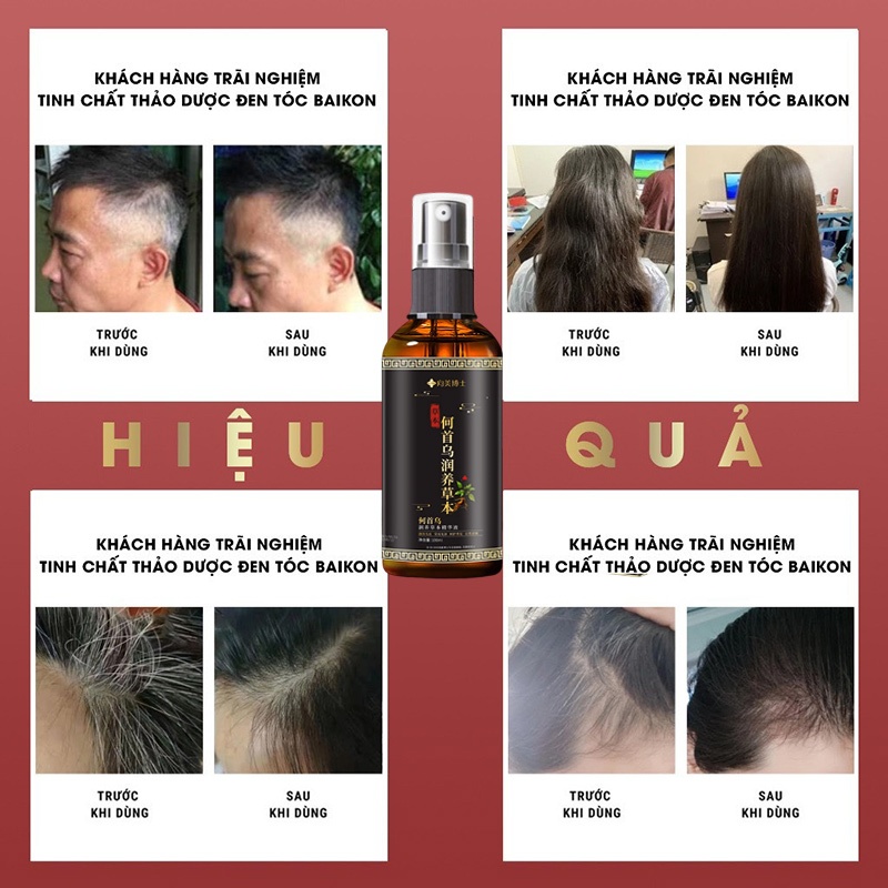 [MUA 2 GIẢM 50%] Tinh Chất Mọc Tóc Nhân Sâm 100ml Dưỡng Tóc Chắc Khỏe Hỗ Trợ Giảm Gãy Rụng Và Nuôi Dưỡng Da Đầu