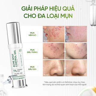 [HÀNG TẶNG] Gel Chấm Mụn - DAILY EFFECT Acne Spot Control Gel (5g)