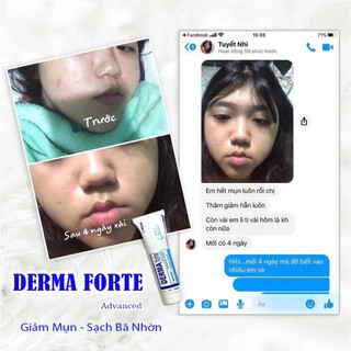Derma Forte và Derma Forte Advanced Topical Gel 15g Gel Giảm Mụn Ẩn, Thâm Cho Mọi Loại Da