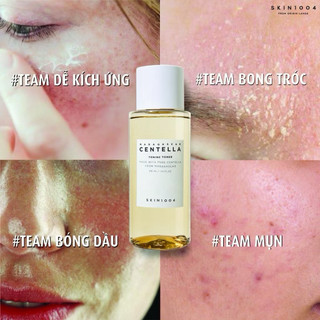 [Skin1004] Nước hoa hồng dịu da SKIN1004 Madagascar Centella Toning Toner 210ml