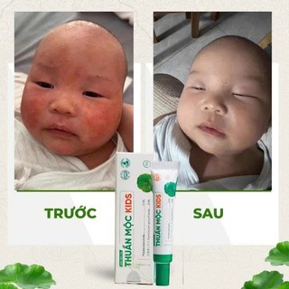 Combo kem bôi da Thuần mộc kids, kem bôi da Thuần mộc vàng không Corticoid