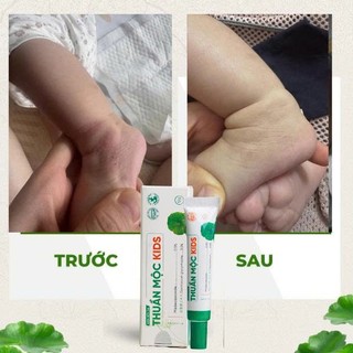 Combo kem bôi da Thuần mộc kids, kem bôi da Thuần mộc vàng không Corticoid