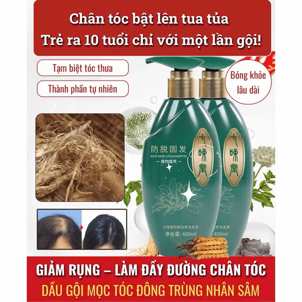 Dầu Gội Chiết Xuất Gừng Cao Cấp Kích Thích Mọc Tóc Ngăn Ngừa Tóc Gãy Rụng Giúp Mái Tóc Của Bạn Bồng Bềnh Mềm Mại