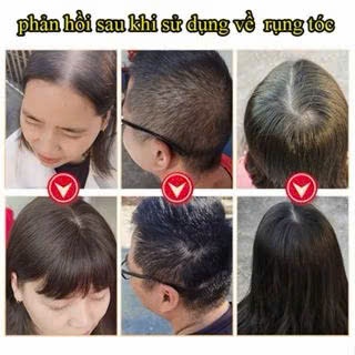 Dầu Gội Chiết Xuất Gừng Cao Cấp Kích Thích Mọc Tóc Ngăn Ngừa Tóc Gãy Rụng Giúp Mái Tóc Của Bạn Bồng Bềnh Mềm Mại