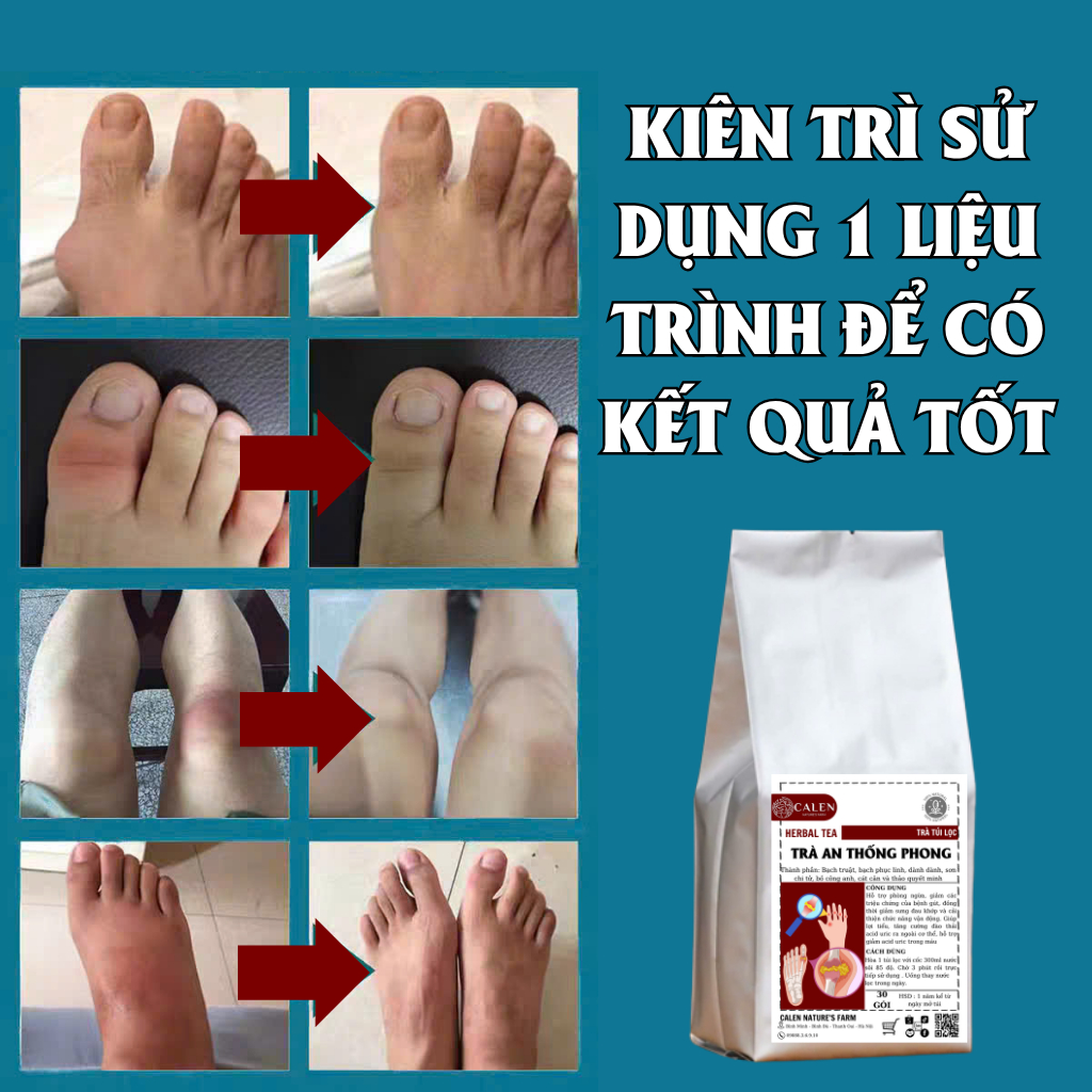 Trà An Thống Phong Calen Nature's Farm lợi tiểu đào thải acid uric, giảm sưng đau khớp cải thiện chức năng vận động