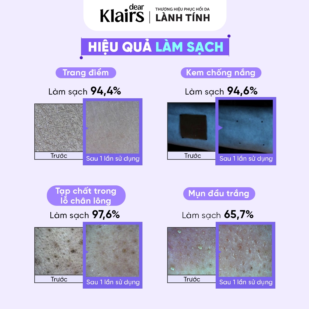 [KOL] Nước tẩy trang Dear Klairs Supple Preparation Unscented Cleansing Water 400ml