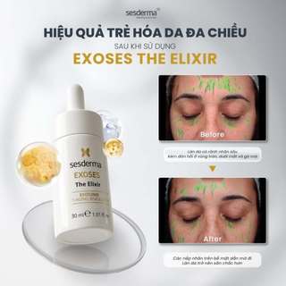 Sesderma Exoses The Elixir 30ml - Tinh chất chiết tế bào gốc Exosome sửa chữa, tân tạo tế bào và trẻ hoá đa chiều 30ml