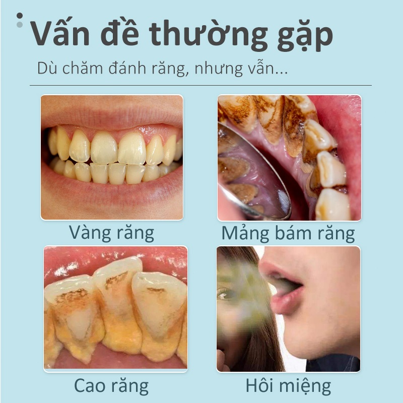 Kem đánh răng Bột làm trắng răng IUALLURE 50g Làm trắng răng Loại bỏ vết ố vàng Hơi thở thơm mát Giảm viêm nha chu