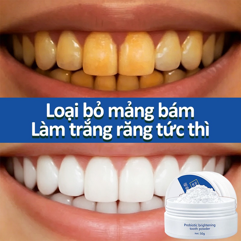 Kem đánh răng Bột làm trắng răng IUALLURE 50g Làm trắng răng Loại bỏ vết ố vàng Hơi thở thơm mát Giảm viêm nha chu
