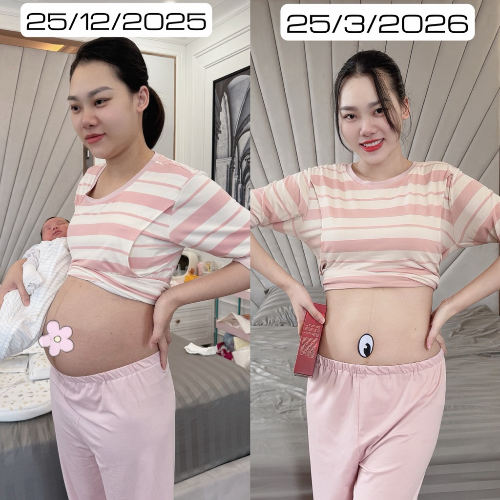 COMBO 3 GEL GỪNG QUẾ TẶNG 2 TRÀ TÁO MÈO THẢI MỠ