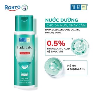 Nước dưỡng ẩm Hada Labo Acne Care Calming Lotion dành cho da dầu mụn, da nhạy cảm 170ml