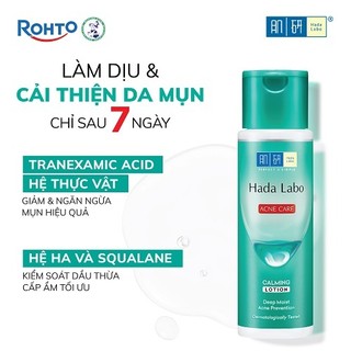 Nước dưỡng ẩm Hada Labo Acne Care Calming Lotion dành cho da dầu mụn, da nhạy cảm 170ml
